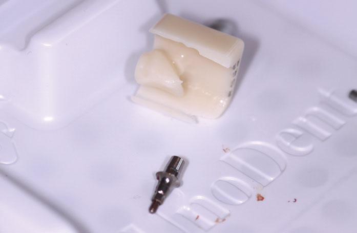 Figure 11: The milled block showing the outline of the crown to be placed, alongside the iSy titanium base