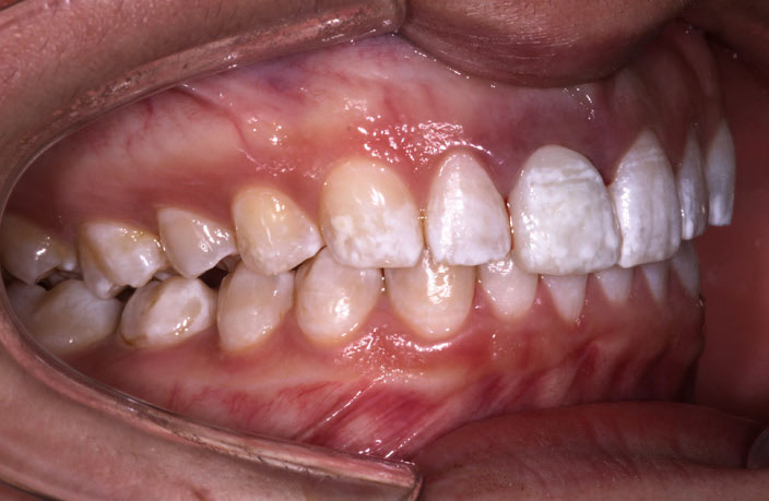 Figure 16: The immediate outcome