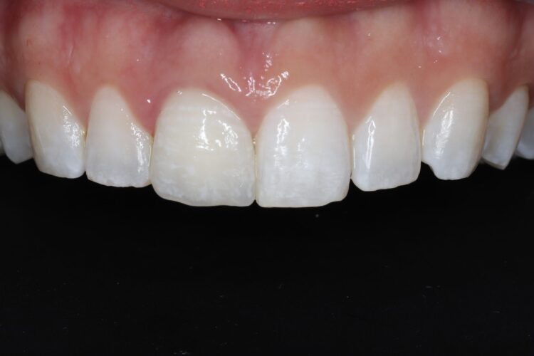 Figure 18: Final result