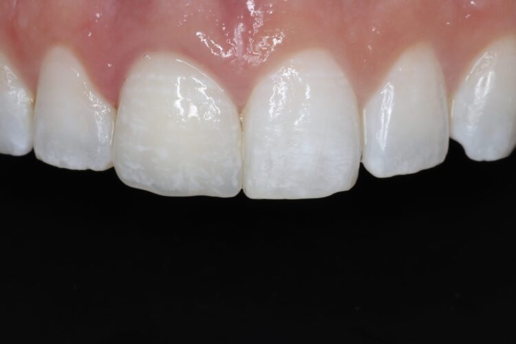 Figure 19: Final result