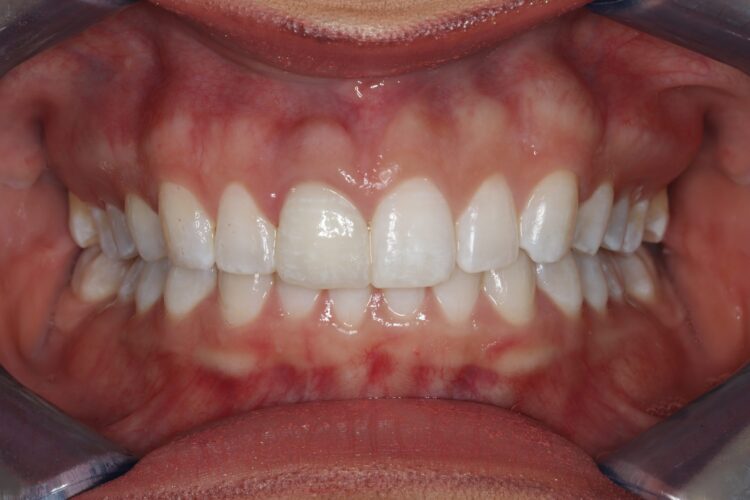 Figure 20: Final result