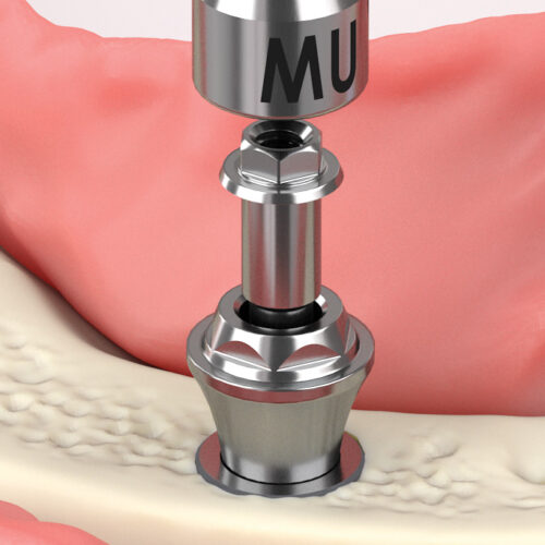 One restorative platform