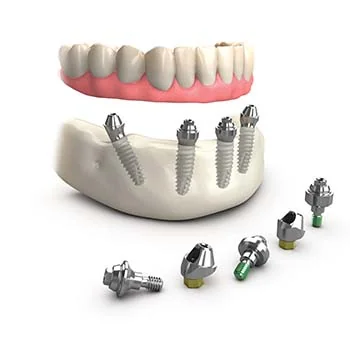 Multi-unit abutments