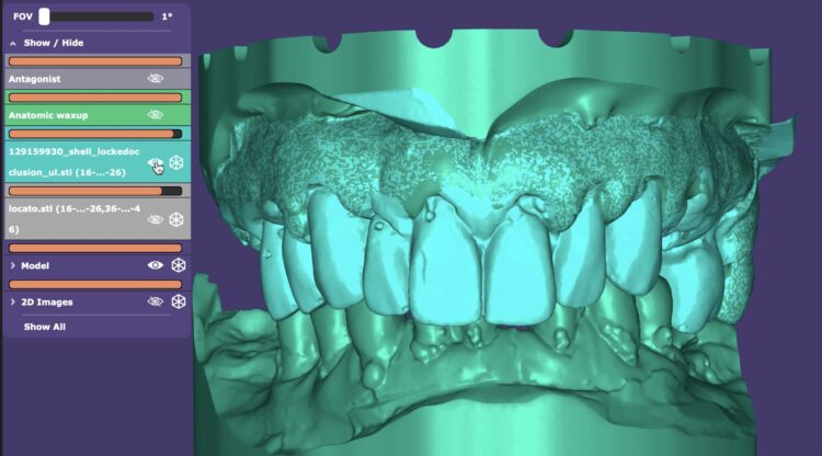Figure 4a: Digital planning initial situation