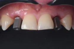 Figure 16: Scan bodies