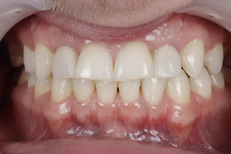 Figure 18: Final review