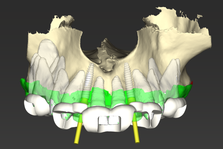 Figure 5: CoDiagnostiX image