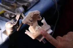 top tips for guided surgery