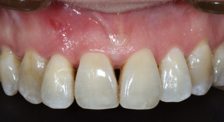 Fig 1 - Presenting situation