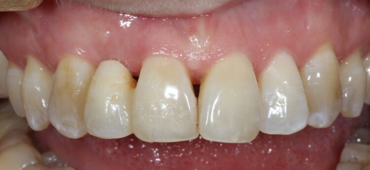 Fig 11 - Seven month review