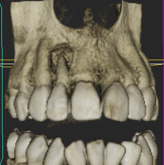 Fig 3 - Imaging assessment