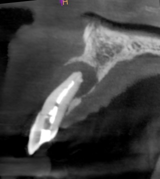 Fig 4 - CT scan diagnostic imaging