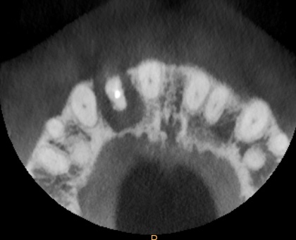 Fig 5 - CT scan diagnostic imaging