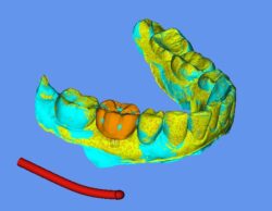 Scan-to-show-maintenance-and-improvement-of-bone-and-soft-tissue-volume