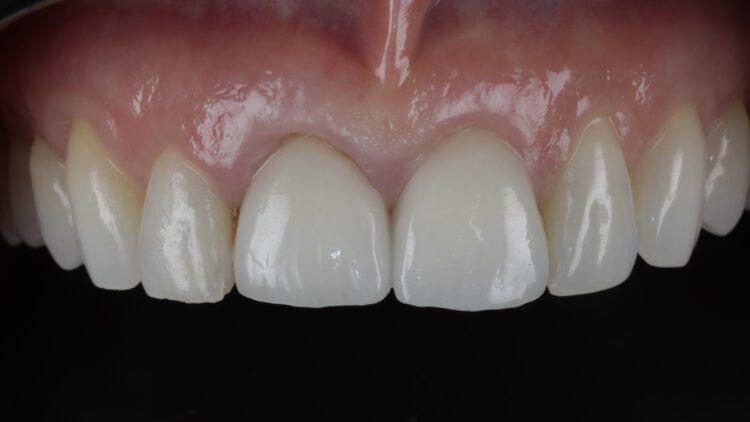 Figure 1: Initial presentation upon referral
